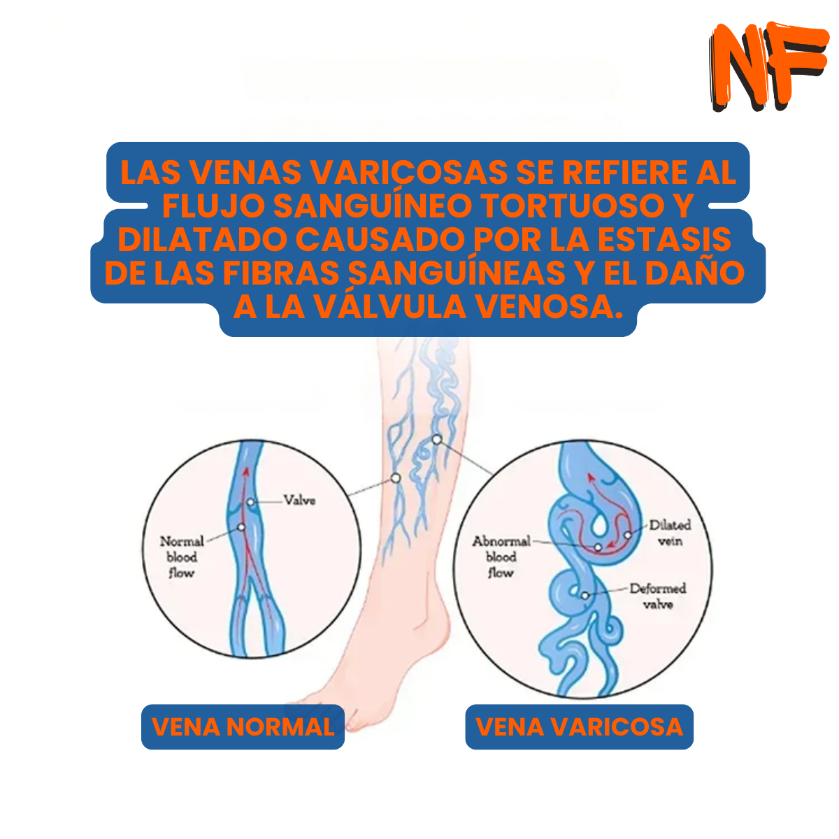 enefe.store_laser-para-tratamiento-de-piel_pic-3
